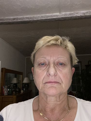 Customer photo review of Sarahbio - huile de pépins de figue de barbarie - 30 mL