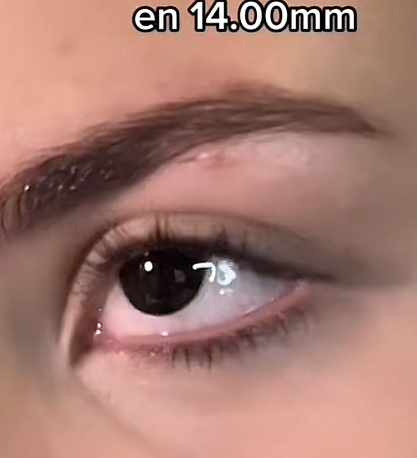 Customer photo review of Blind Black Contacts