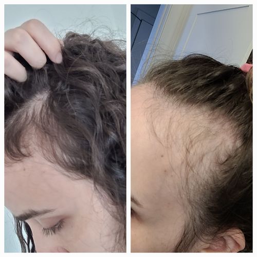 Customer photo review of Growth & Shine Hair Oil