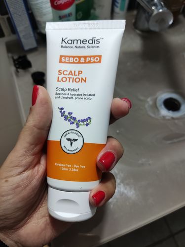Customer photo review of קרם טיפולי לקרקפת | SEBO & PSO SCALP LOTION