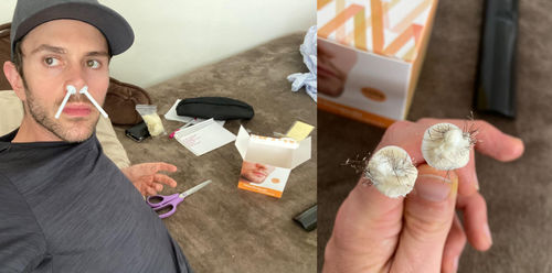Customer photo review of NäsVård™ Näshår Vaxkit