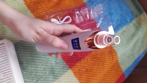 Customer photo review of iBeauty Starter Microdermabrasion Kit