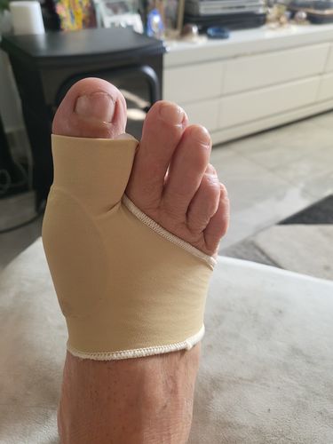 Customer photo review of מיישר בוהן ועצם בולטת מכף הרגל | מבית פומי ספורט