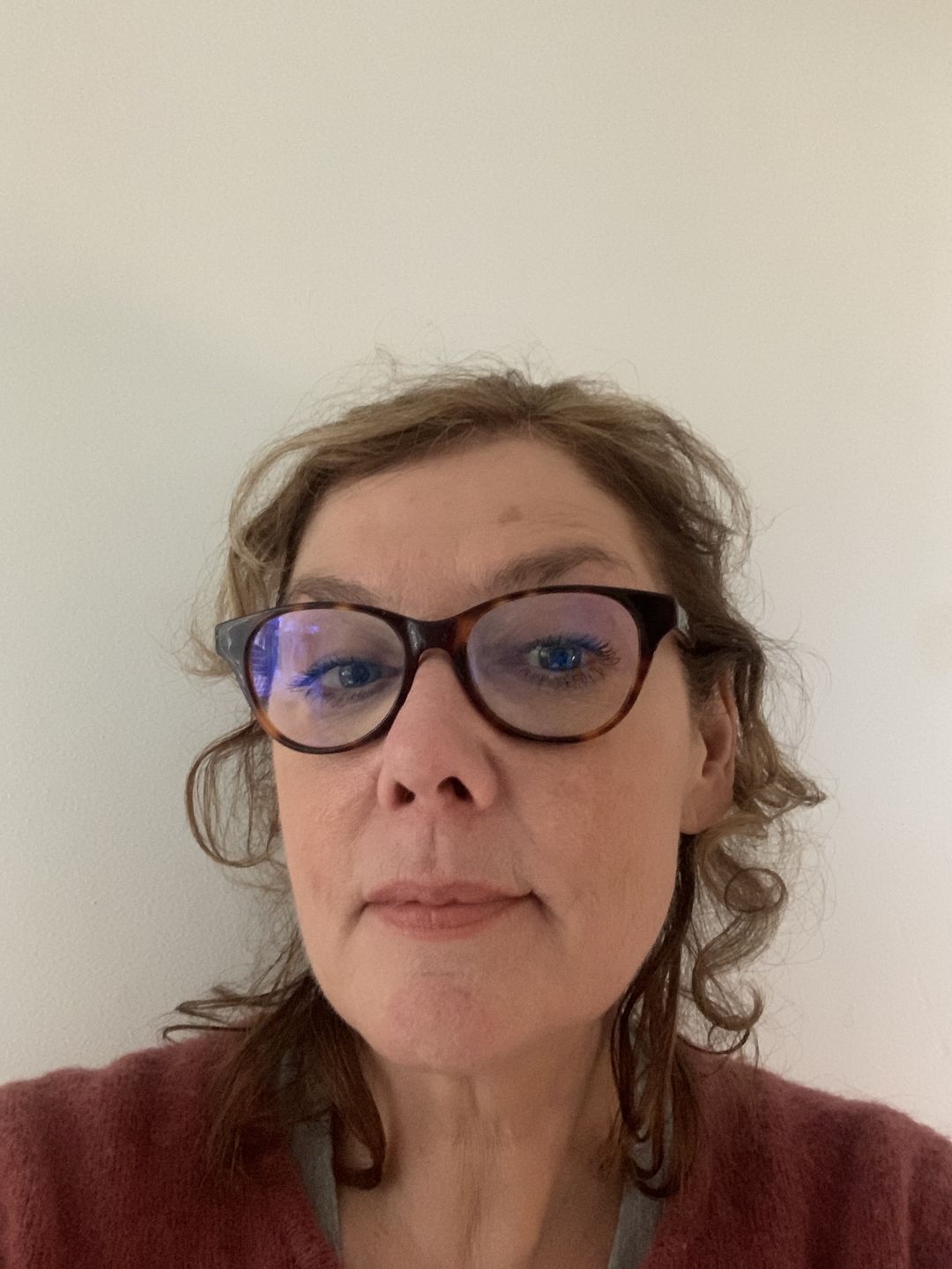 Customer photo review of Double Stem Cell Repair Serum