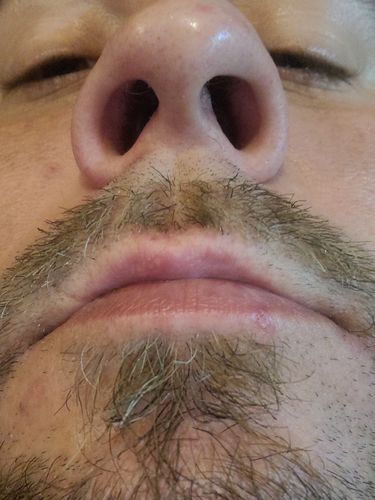 Customer photo review of NäsVård™ Näshår Vaxkit
