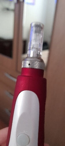 Customer photo review of Micro Needling Pen Kit
