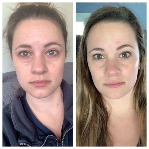 Customer photo review of SkinRevive™ Magisk Ögonkräm
