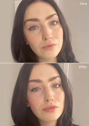 Customer photo review of LäppPlumper™ Omedelbar Läppförstorare