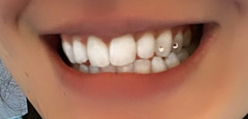 Customer photo review of Crystal Clear 1.8mm - 6-pack