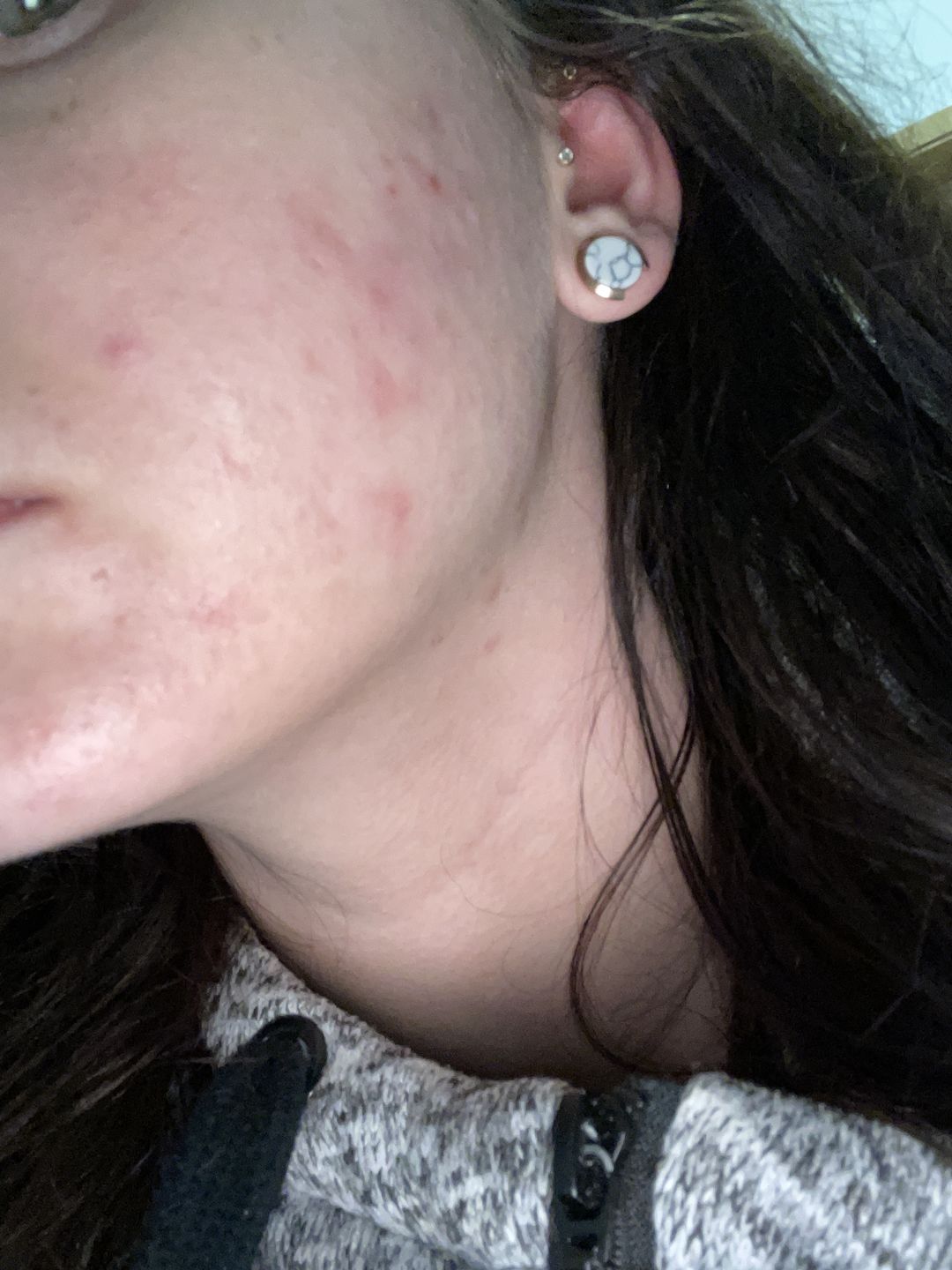 Customer photo review of Sleek Skin Serum 30ml
