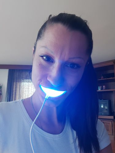 Customer photo review of PAP+ LED Teeth Whitening Kit