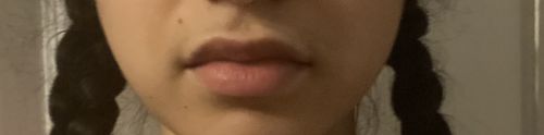 Customer photo review of LipFix: LipFlip