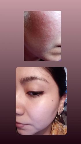 Customer photo review of Gel de Aloe Vera 2X1