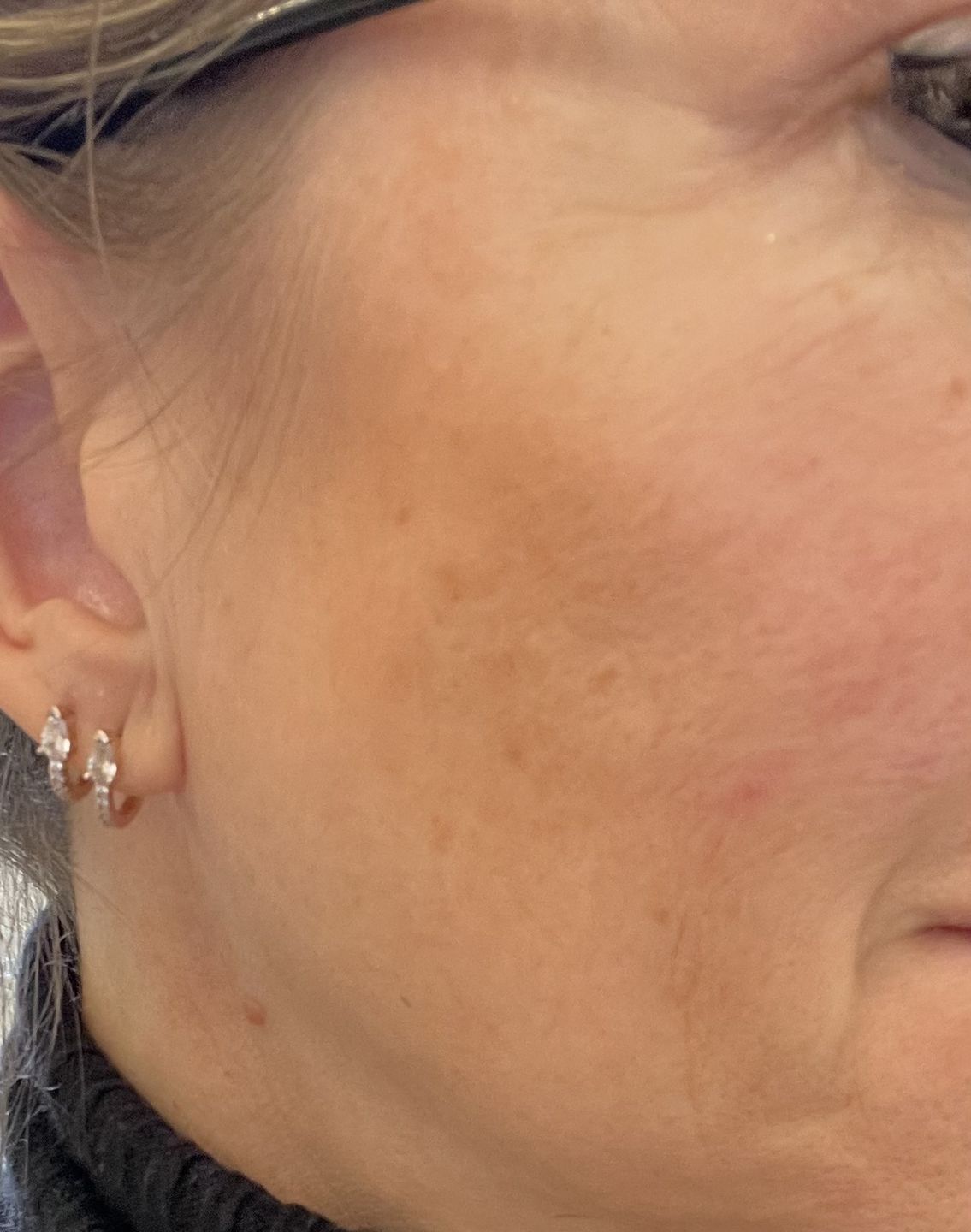 Customer photo review of Good Skin - 3 mois