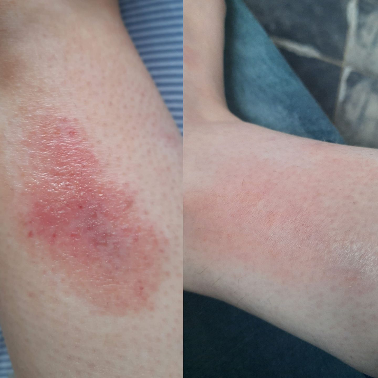 Customer photo review of Soothing Spray