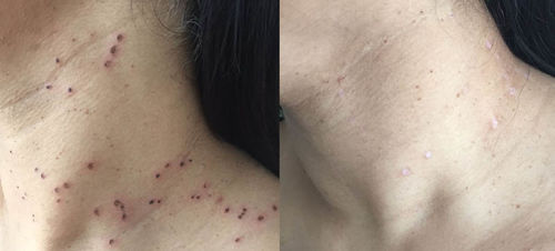 Customer photo review of HudFliksKlipp™
