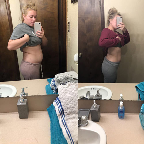 Customer photo review of Hot sale - Natural Belly Drainage Ginger Oil