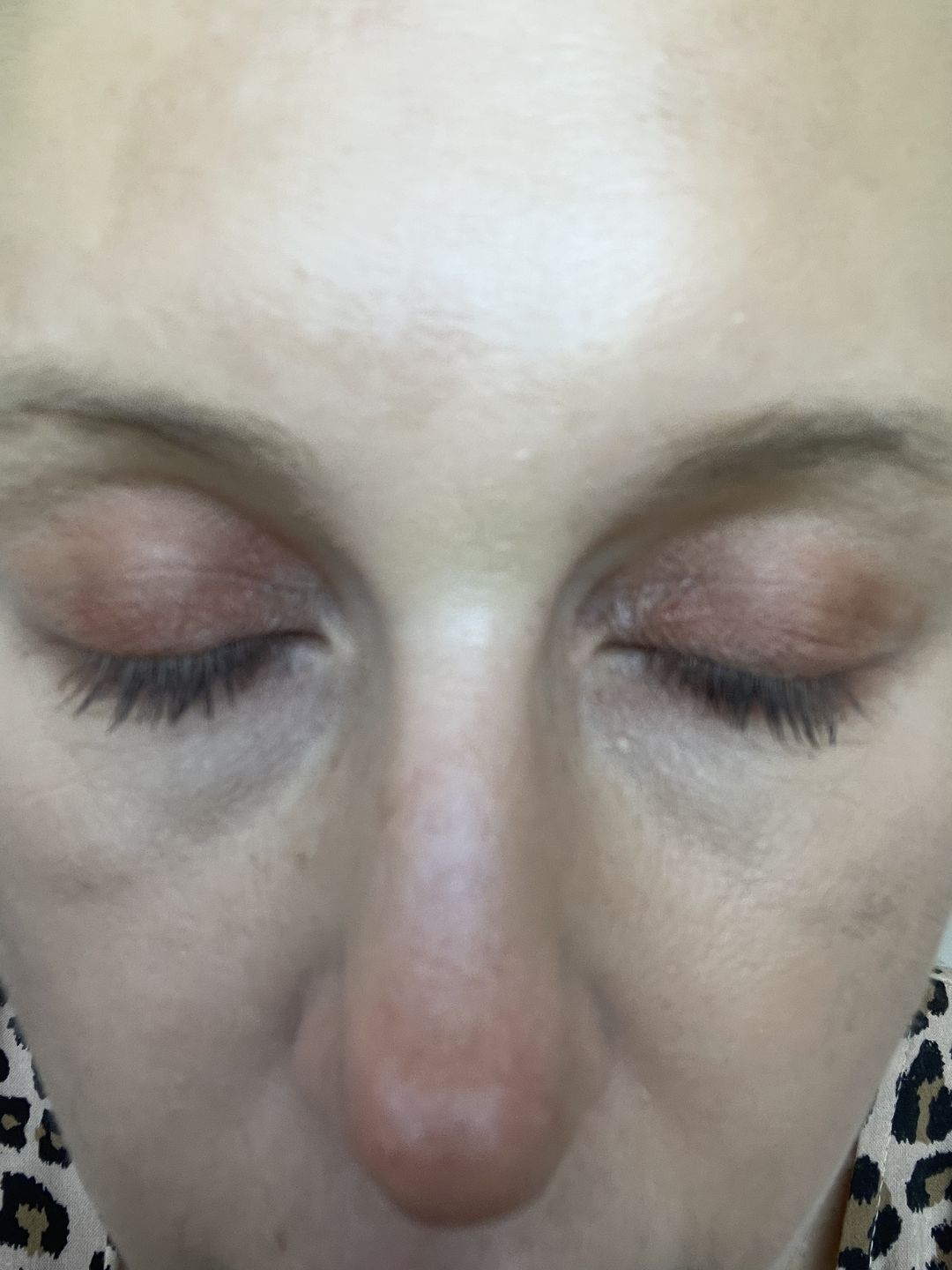 Customer photo review of Purely Lashes Lash Growth Serum