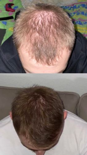 Customer photo review of Growth & Shine Hair Oil
