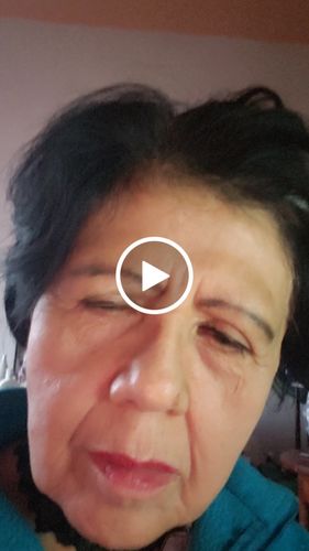 Customer video review of EyeFix: Upper and Lower Eyes