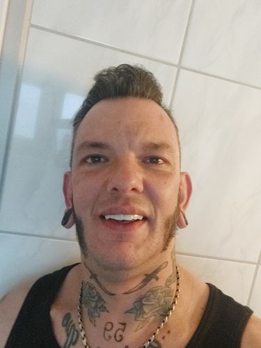 Customer photo review of Tooth-Veneer