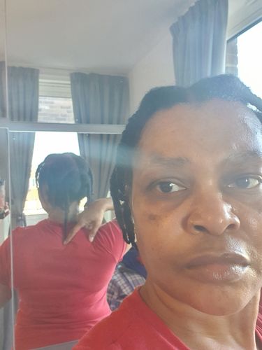 Customer photo review of Roots - Scalp & Beard Serum