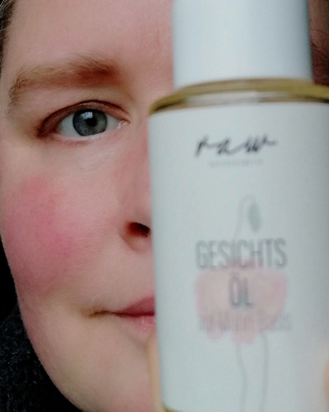 Customer photo review of Gesichtsöl "Mohn" (bei Hautirritationen)