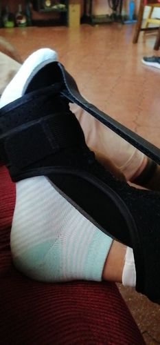 Customer photo review of Attelle plantaire réglable pour la fasciite nocturne