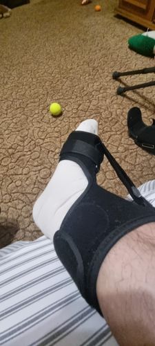 Customer photo review of Attelle plantaire réglable pour la fasciite nocturne