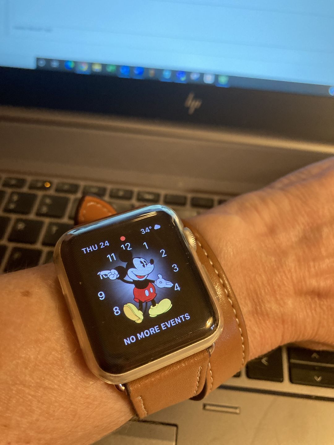 Customer photo review of Double Tour Paris Vegan Leather Band (5 Designs)