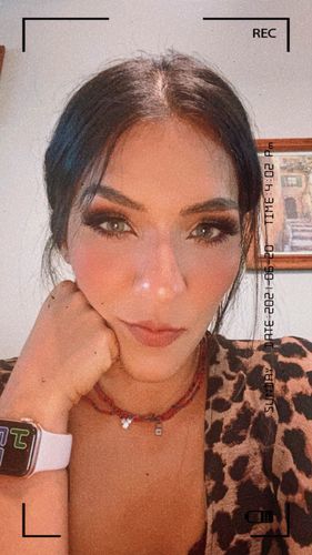 Customer photo review of Aurora Colored Contact Lenses