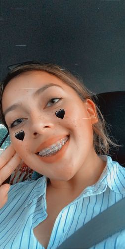 Customer photo review of Aurora Colored Contact Lenses