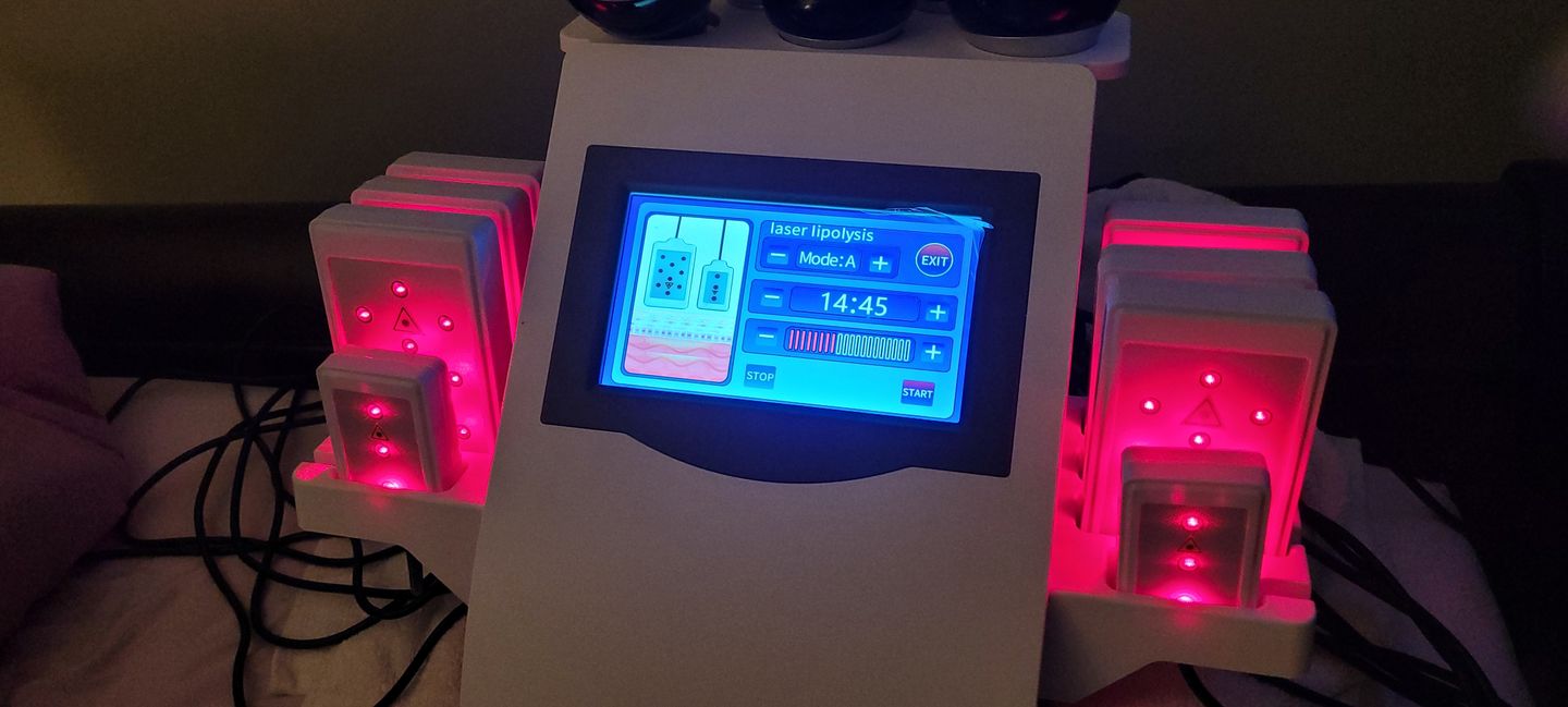 Customer photo review of Adonis 6 in 1 Cavitation Machine for Fat Blasting