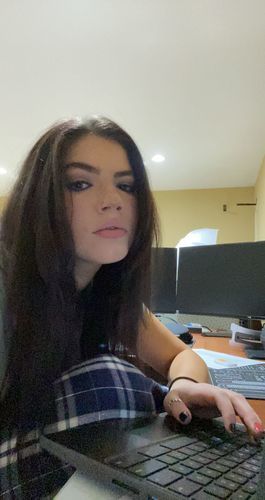 Customer photo review of Aurora Colored Contact Lenses