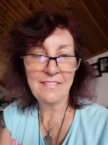 Customer photo review of Tooth-Veneer