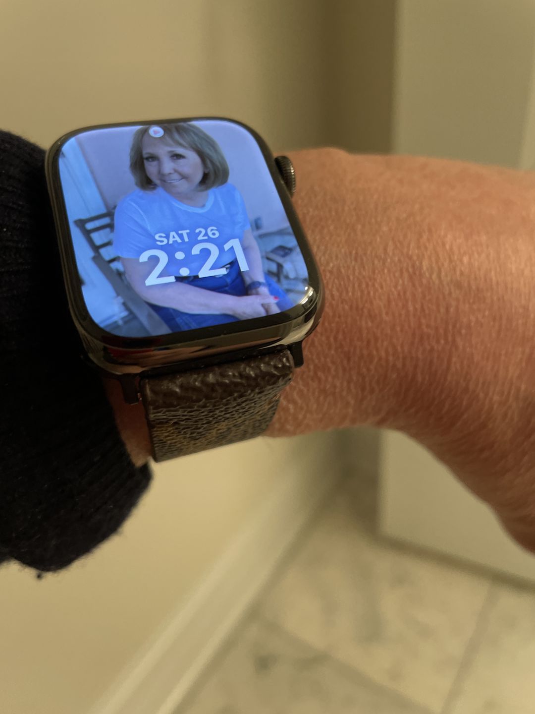 Customer photo review of Apple Watch Band Classic LV Monogram