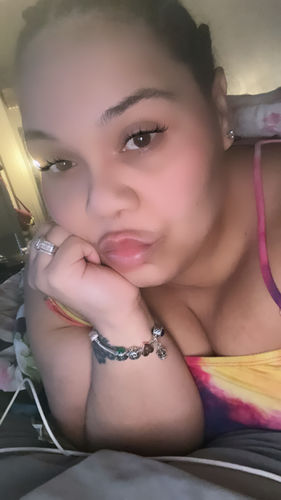Customer photo review of LipFix: Filler