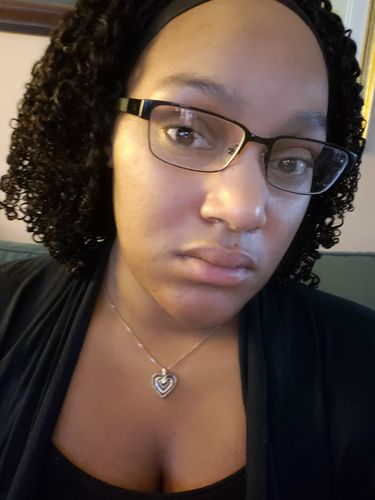 Customer photo review of Tea Tree & Honey Black Soap Facial Bar