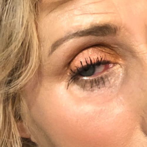 Customer photo review of Vibrant Glamour ™ Magic Eye Cream