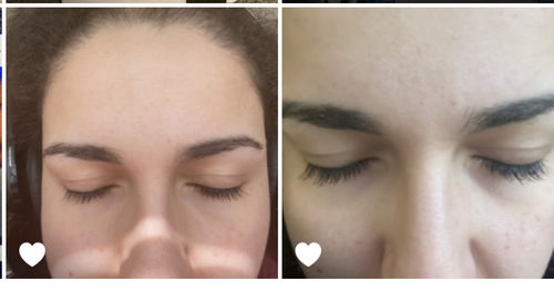Customer photo review of Eyelash Enhancing Serum