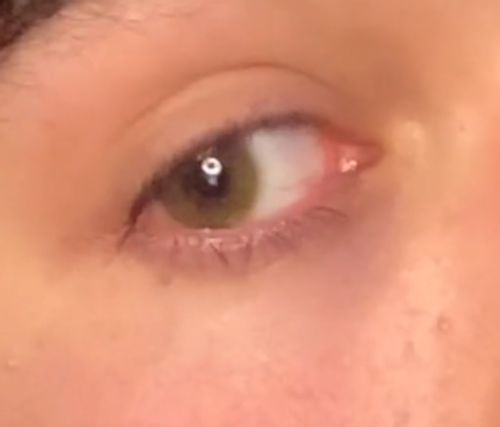 Customer photo review of EYEVOS Polar Lights Brown Colored Contact Lenses