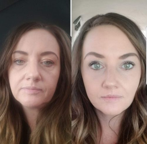 Customer photo review of Vibrant Glamour ™ Magic Eye Cream