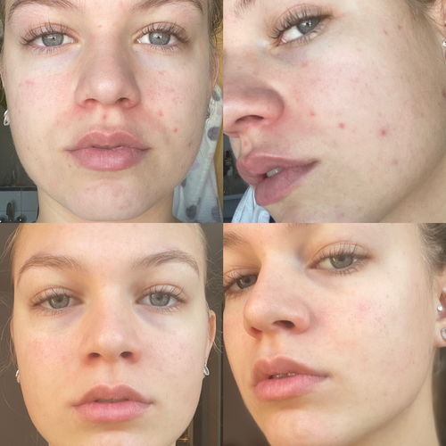 Customer photo review of Reinigungsgel