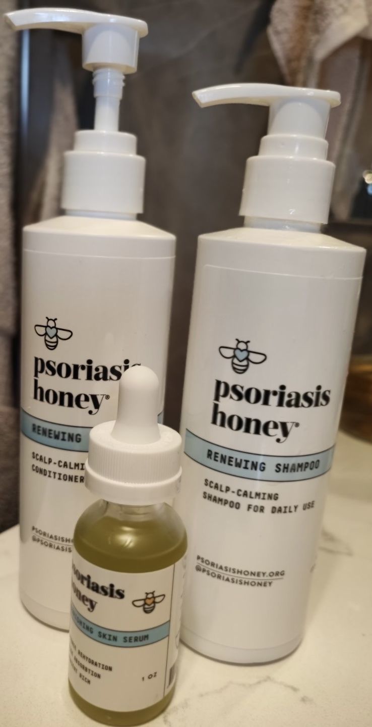 Customer photo review of Psoriasis Honey Scalp Nourishing Kit