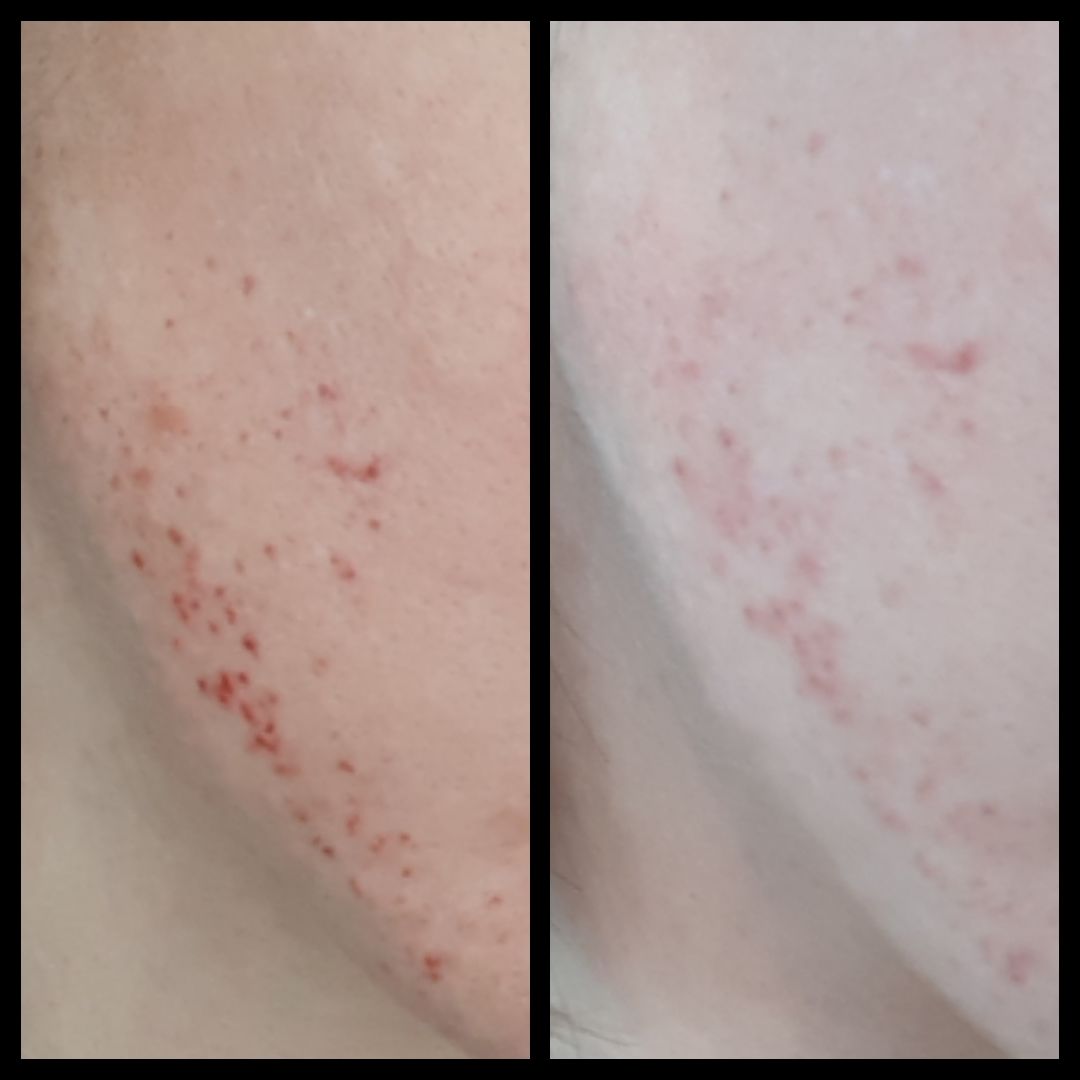 Customer photo review of Repair, Healing & Relaxing Set