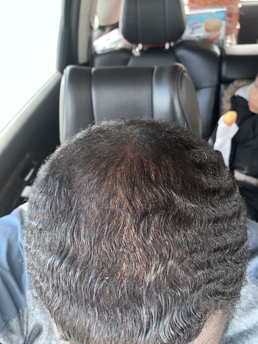 Customer photo review of Kerry Berry Growth Oil