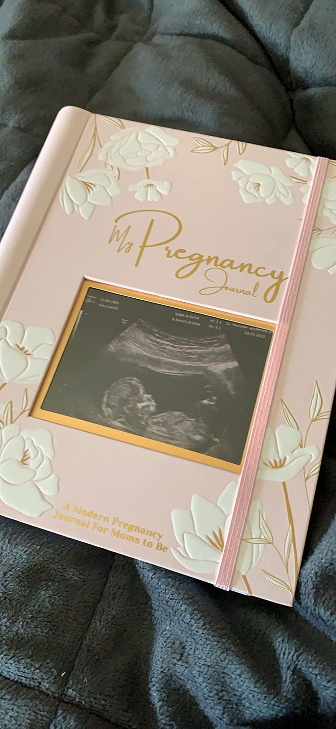 Customer photo review of Pregnancy Journal (Blossom)