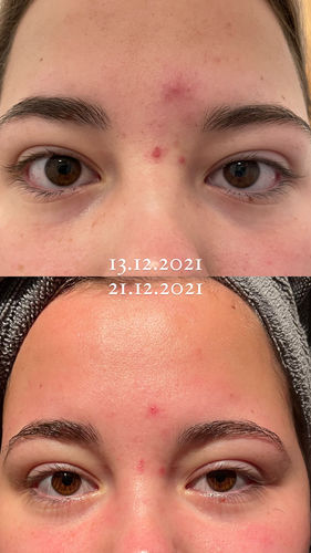 Customer photo review of Feuchtigkeitscreme