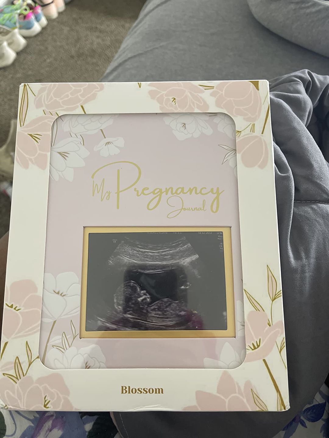 Customer photo review of Pregnancy Journal (Blossom)