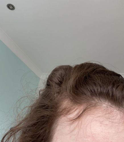 Customer photo review of Growth & Shine Hair Oil